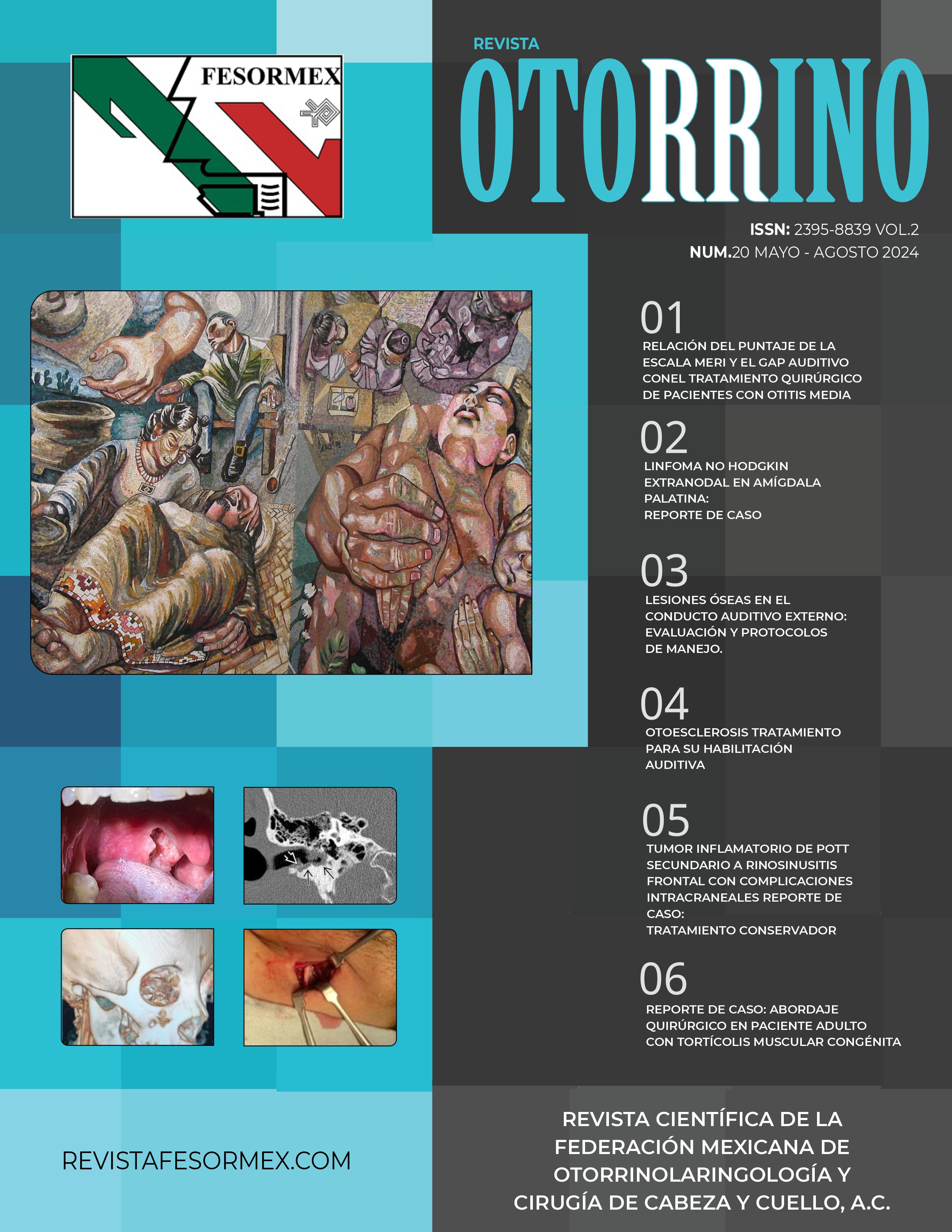 revista