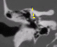 f4.png